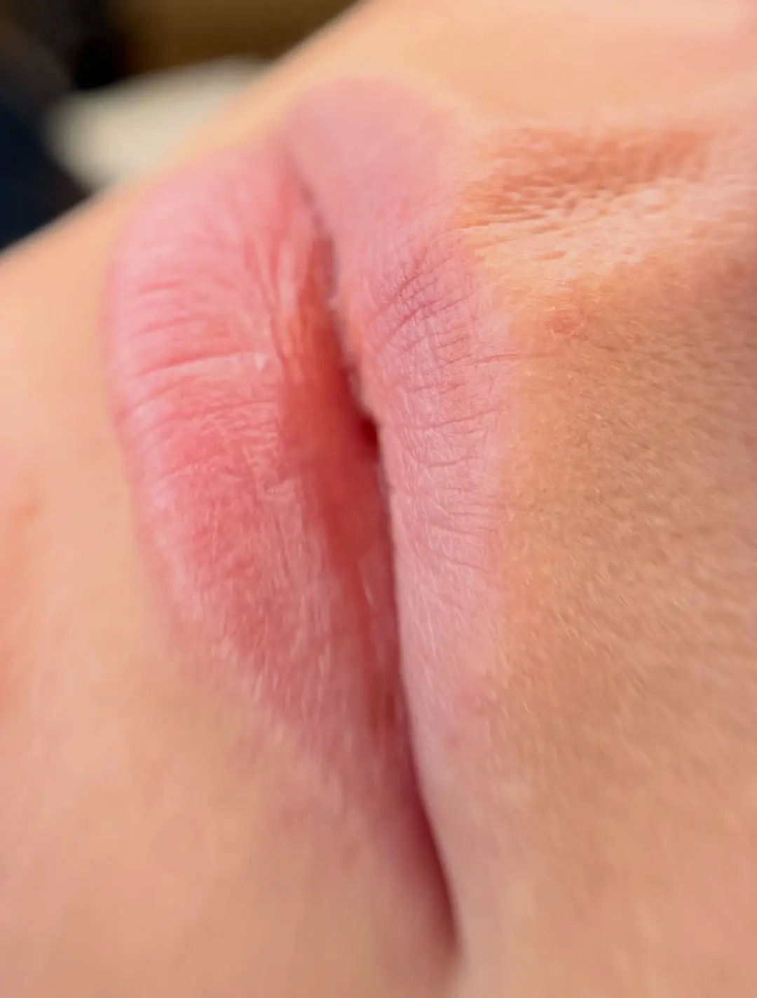 does lip tattooing hurt