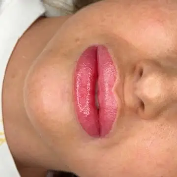 lip tattoo before and after thin lips