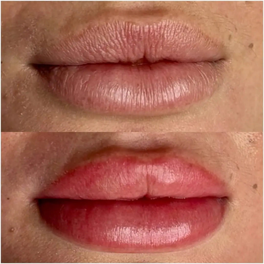 lip tattoo healing