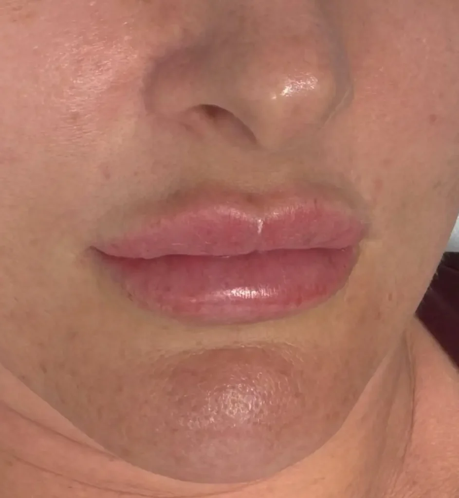 lip tattoo pain scale