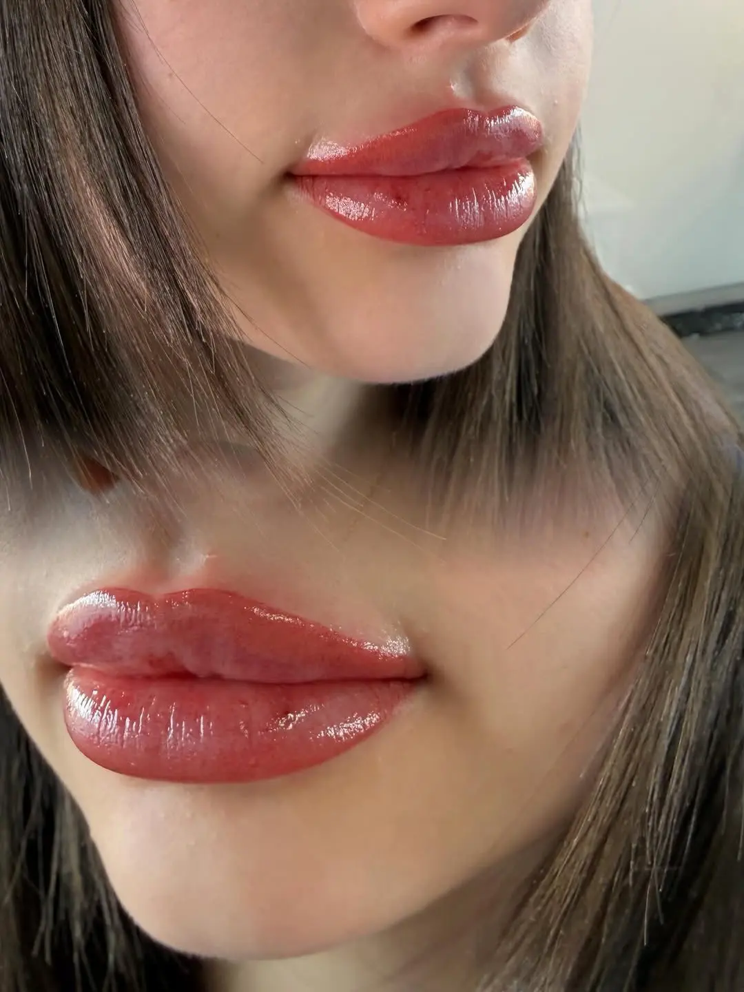 lip tattoo removal