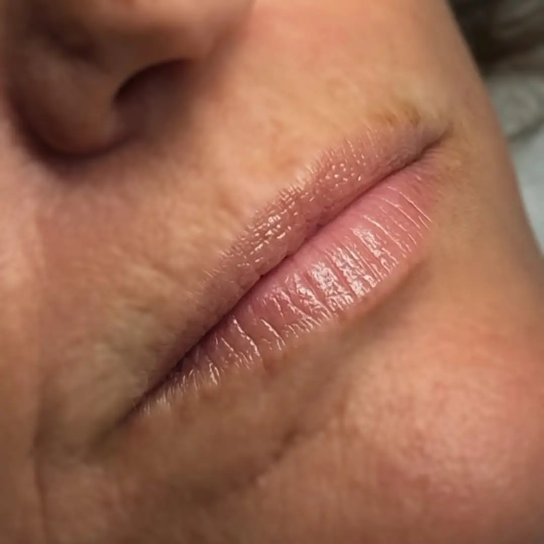lip tattoo swelling