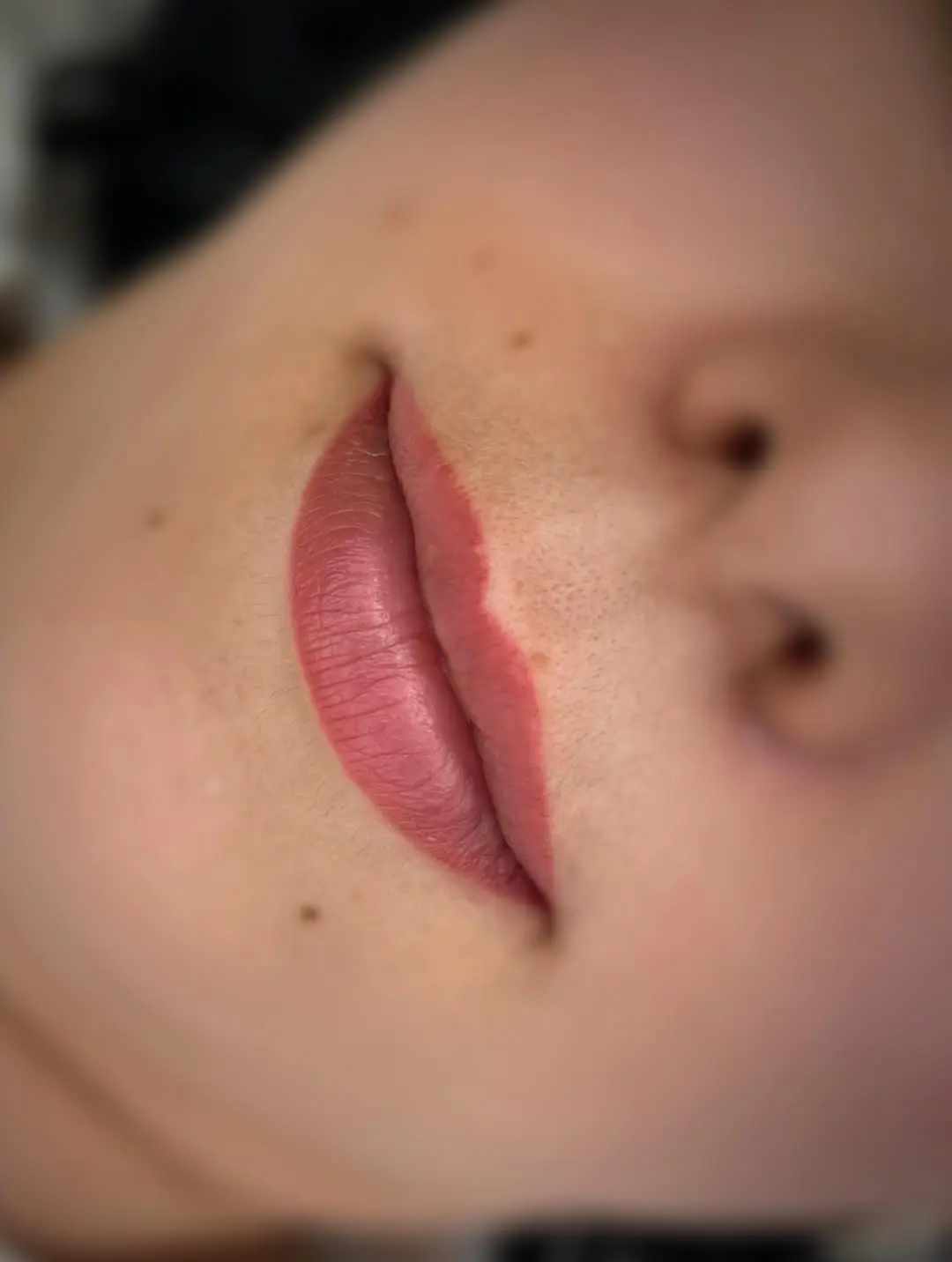 lip tattoo treatment